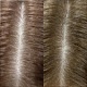 Избавиться от выпадения волос за 3 месяца Фото: до/после